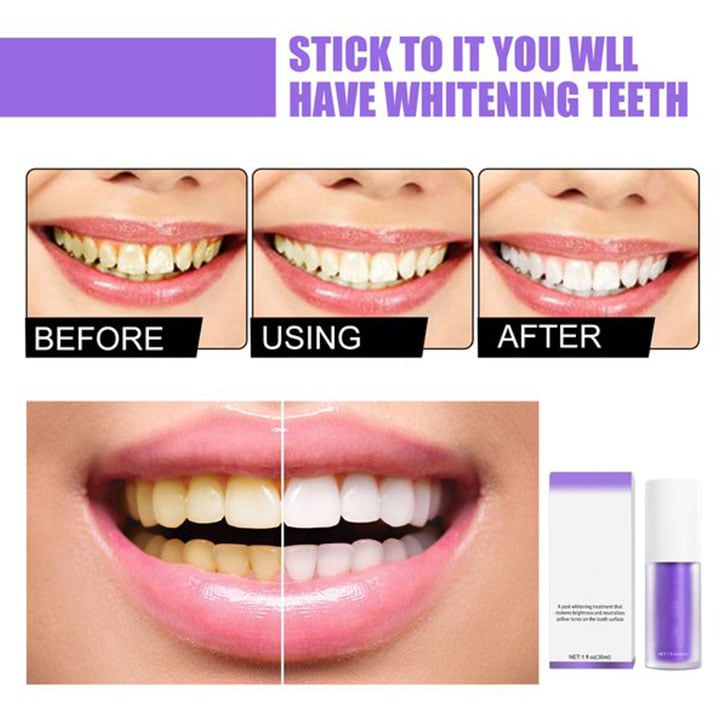 🔥Last Day Special🔥: Clean Doctor™  Purple Essence Toothpaste
